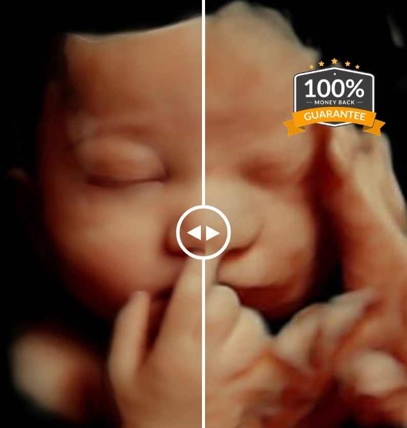 3D, 4D, 5D and HD Ultrasound. Turn your ultrasound into a REALISTIC ultrasound with your baby's face, HD ultrasound gift Ultrasound image 1