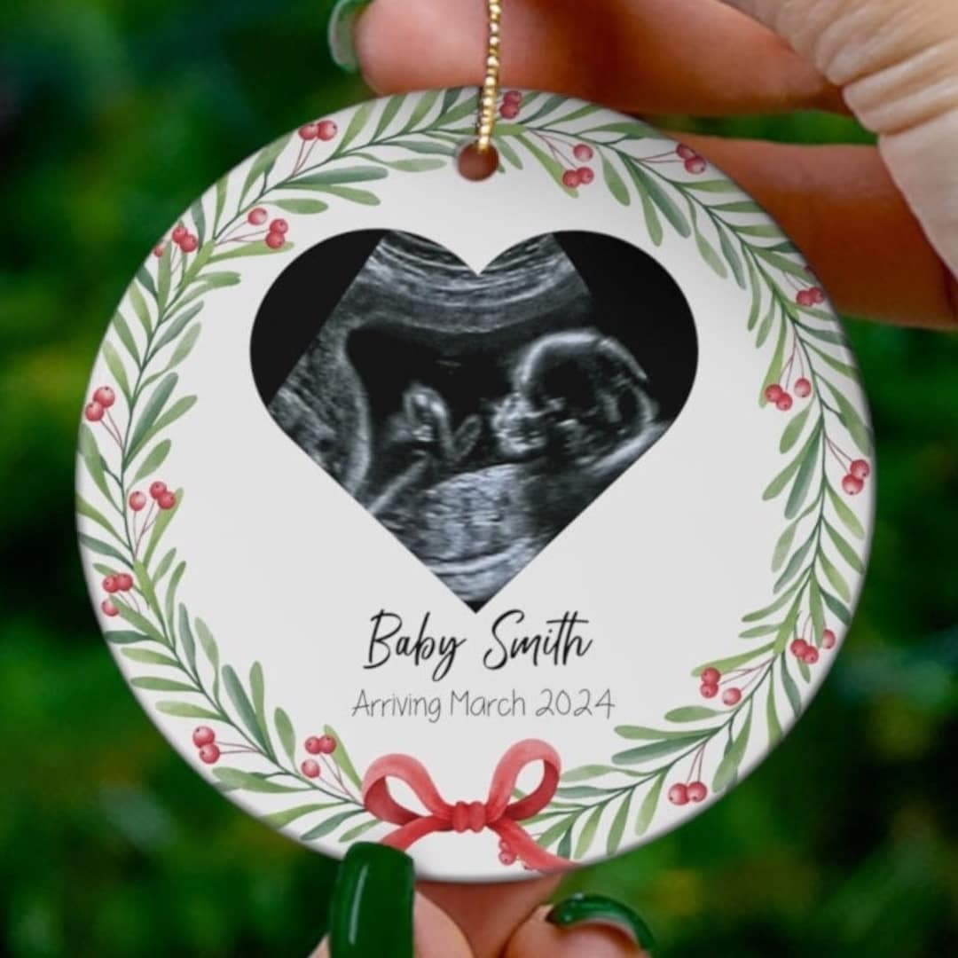 Sonogram Ornament Ultrasound Ornament Design/ultrasound Ornament