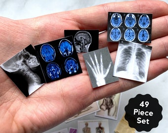 Miniature X-rays Posters Desk Decor 1:12 Scale Dollhouse Wall Art Photographs Miniature Medical Set - Digital Download PDF - 49 Pieces