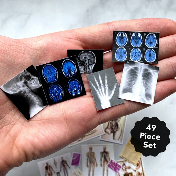 Miniature X-rays Posters Desk Decor 1:12 Scale Dollhouse Wall Art Photographs Miniature Medical Set - Digital Download PDF - 49 Pieces