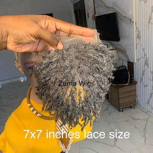 Extensiones de rastas personalizadas para la caída del cabello, solución para la alopecia