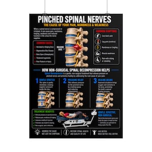 May include: A black educational poster titled Pinched Spinal Nerves, featuring anatomical diagrams of the spine, a bulging disc, common symptoms, and a step-by-step explanation of non-surgical spinal decompression therapy with a treatment table.