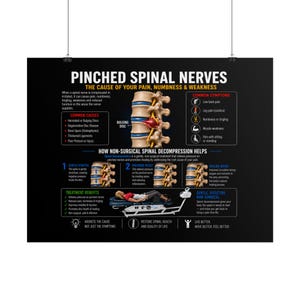 May include: A black educational poster titled PINCHED SPINAL NERVES, THE CAUSE OF YOUR PAIN, NUMBNESS & WEAKNESS. It features anatomical diagrams of a bulging disc, lists common symptoms and causes, and explains non-surgical spinal decompression.