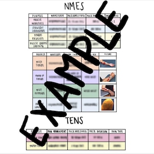 Puede incluir: Un gráfico con el título "NMES" y "TENS" que muestra el propósito, la forma de onda, la frecuencia de pulso, la duración del pulso y otras configuraciones para diferentes tipos de estimulación eléctrica.