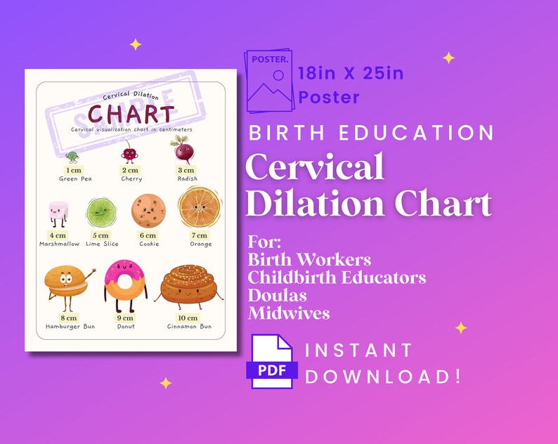 CERVICAL DILATION CHART, Exam Room Poster, Birth Education Chart