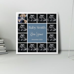 Baby Ultrasound Collage Template| Pregnancy |Parents to be| Unborn Baby| Expecting| Baby First Photo| Canva Printable template