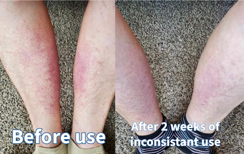 Itch & Rash Relief Oil - Etsy