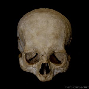 Realistic Human Skull Replica – Aged Skull Model – Ultra-Realistic Bone and Skull Art Piece