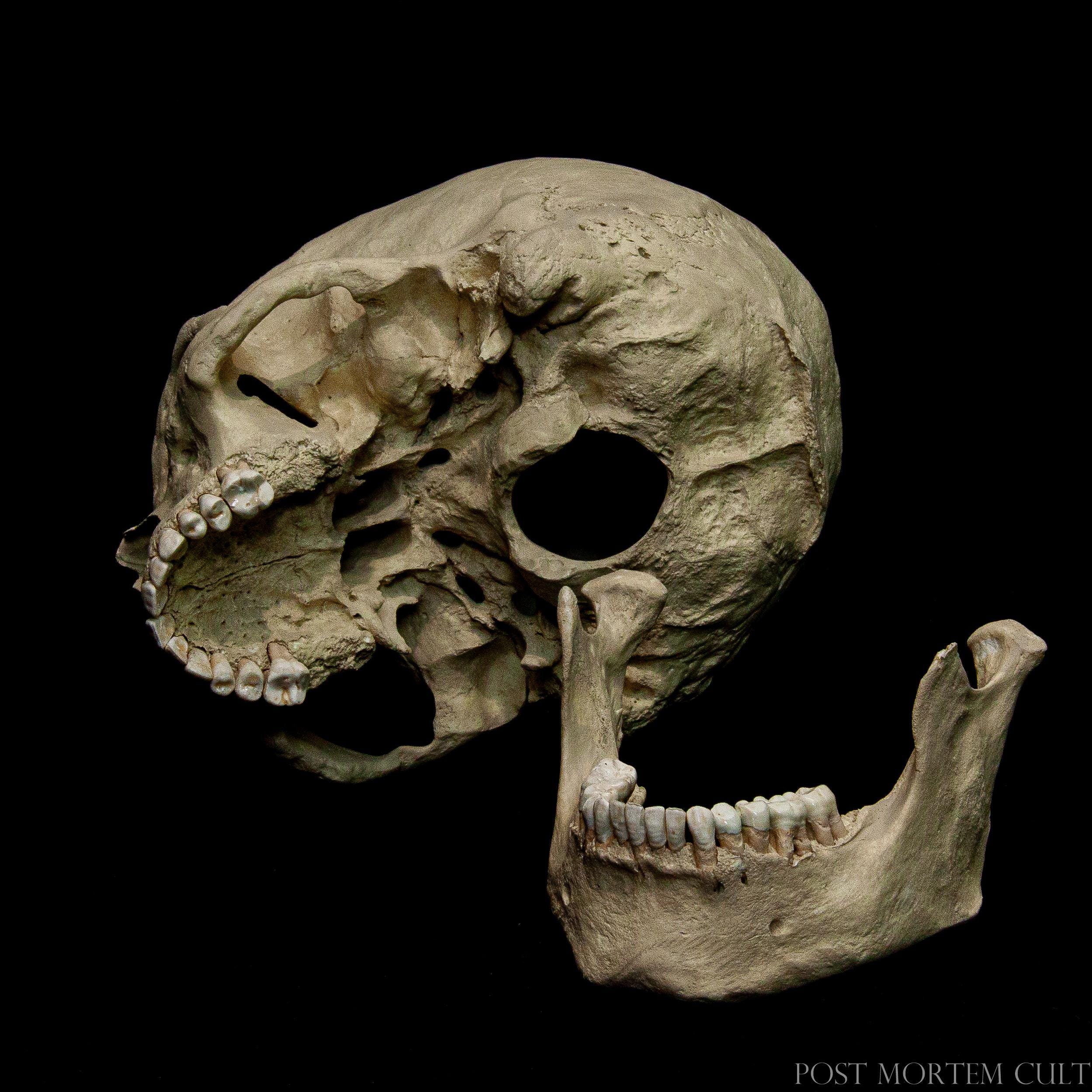 Dentium Tenebris – Human Skull Replica – Life Size Anatomical 