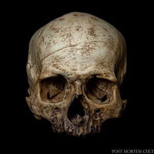Realistic Human Skull Replica - Rudolf Skull - Ossuary Decor - Life-Size Anatomical Model - Handmade