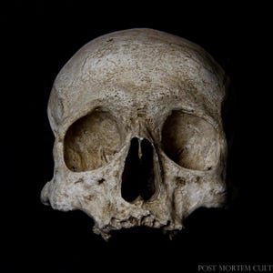 Op de afbeelding: Een close-up van een menselijke schedel, met de oogkassen, de neusholte en de tanden zichtbaar. De schedel is wit met een licht ruwe textuur en is geplaatst tegen een zwarte achtergrond.