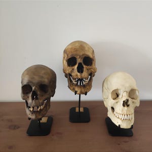 Human Skull Display Stand – Decorative Skull Exhibit for Oddities & Human Bone Decor
