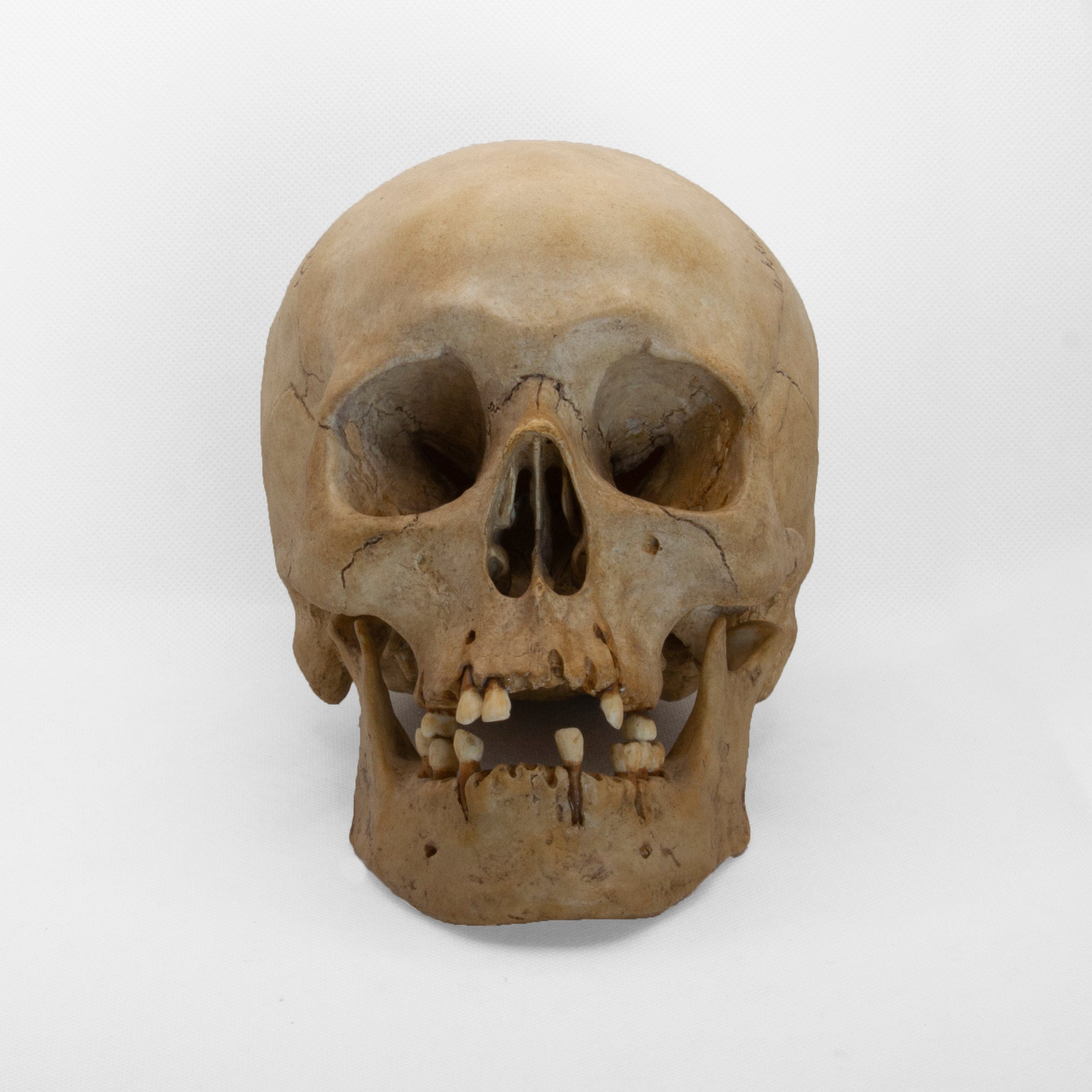 Light Skull – Human Skull Replica – Life Size Anatomical Skull