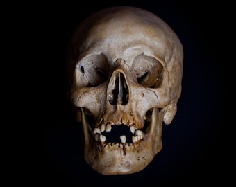 May include: A close-up of a human skull with teeth, set against a black background.