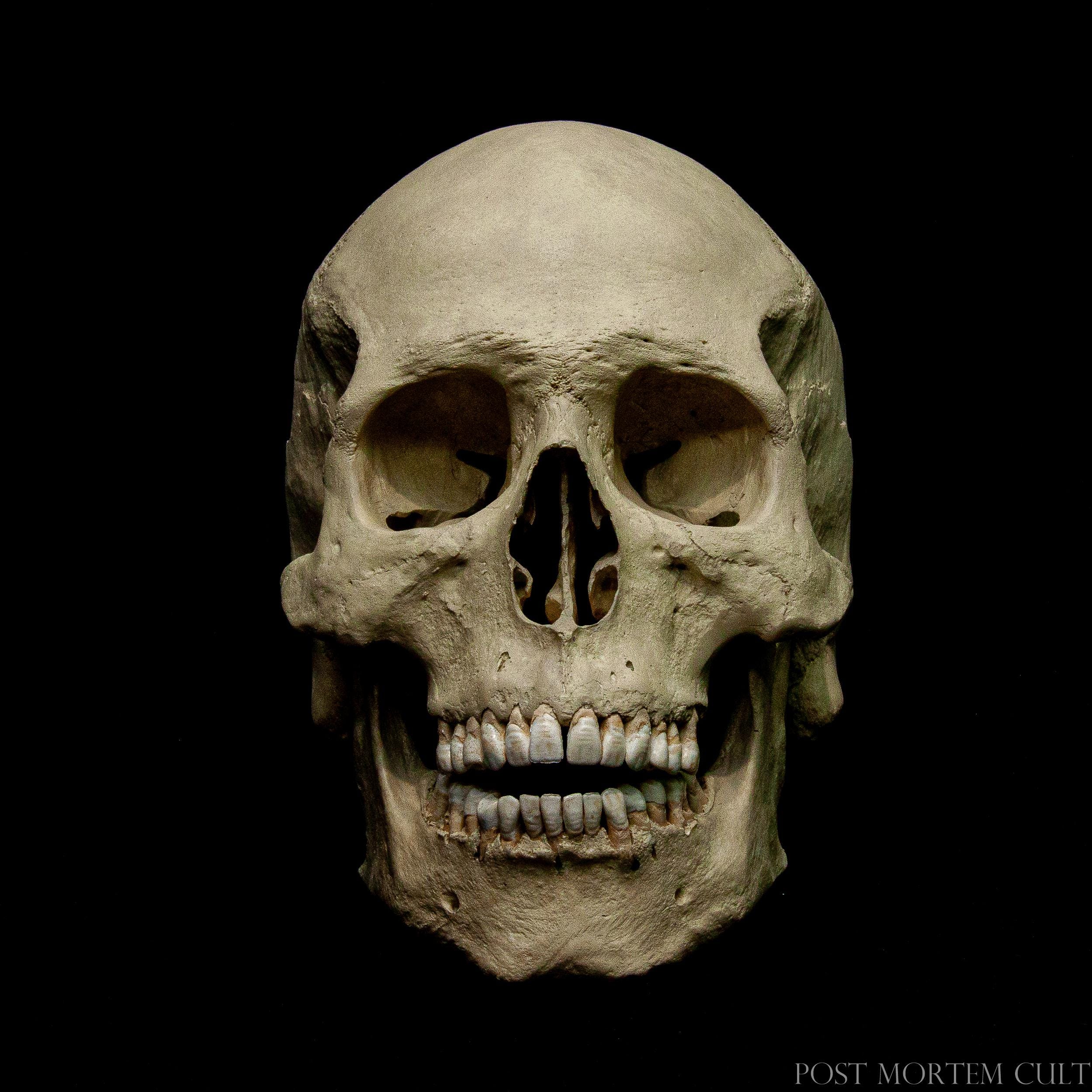 Dentium Tenebris – Human Skull Replica – Life Size Anatomical