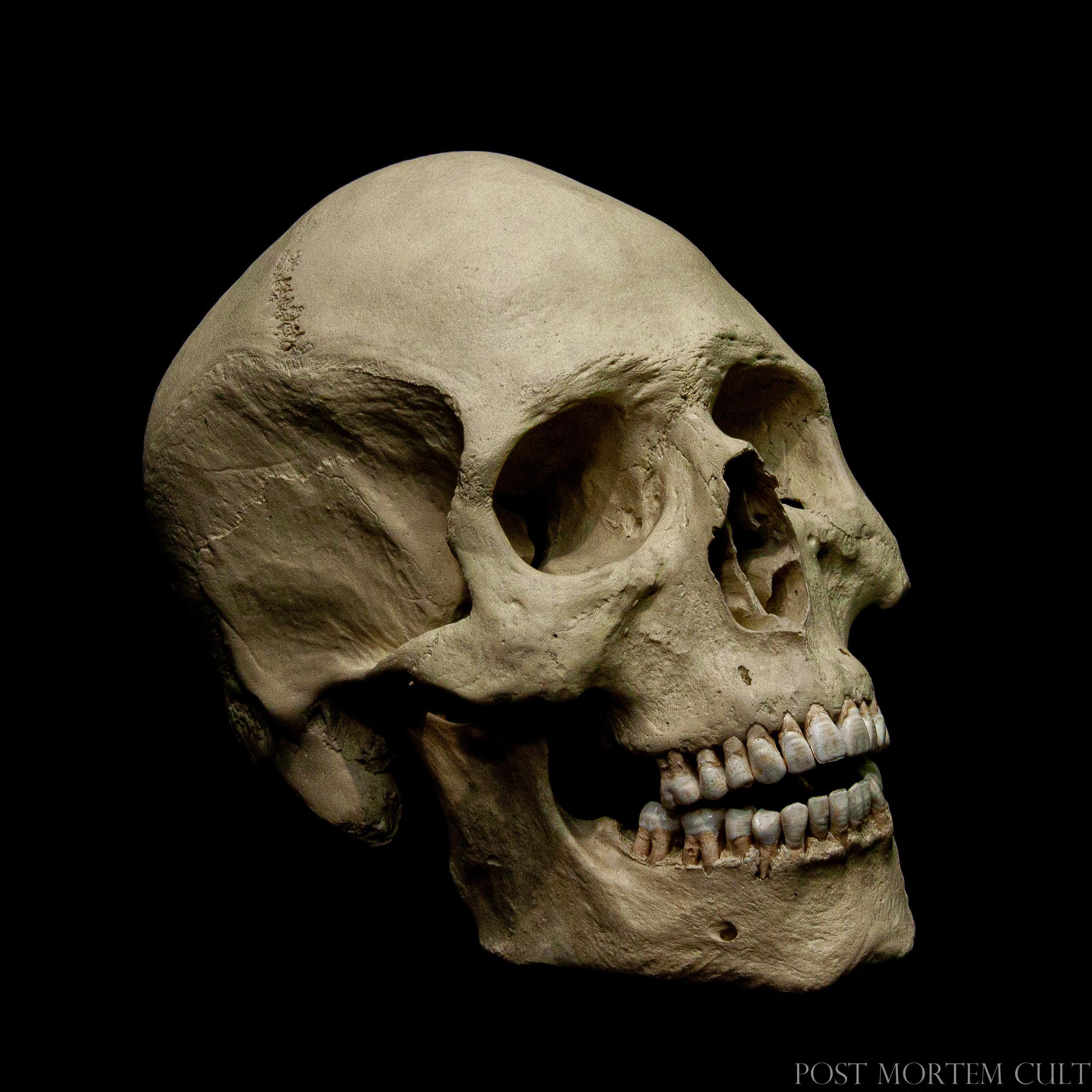 Dentium Tenebris – Human Skull Replica – Life Size Anatomical