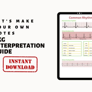 Common Heart Rythmns EKG Interpretation Nursing Study Guide, Cardiac Rhythms Cheat Sheet ...