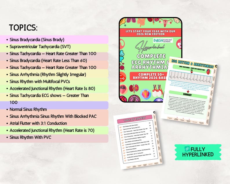 ECG Rhythm & Arrhythmias Study Guide: Nursing School EKG Cheat Sheet ...