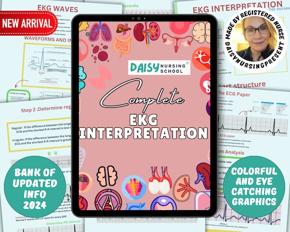 Ekg Study Guide ECG/EKG Interpretation Study Guide & Workbook By Nurse