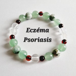 Può includere: Un braccialetto di perline verdi e rosse con le parole "Eczema Psoriasis" scritte su uno sfondo bianco.