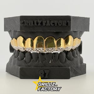 Benutzerdefinierte Gold Top und Bling Bottom Grillz, hochglänzende Schmuckstücke für Künstler, 10K Gold, 14K Gold, 925 Silber, Free Perm Cuts, Mold Kit