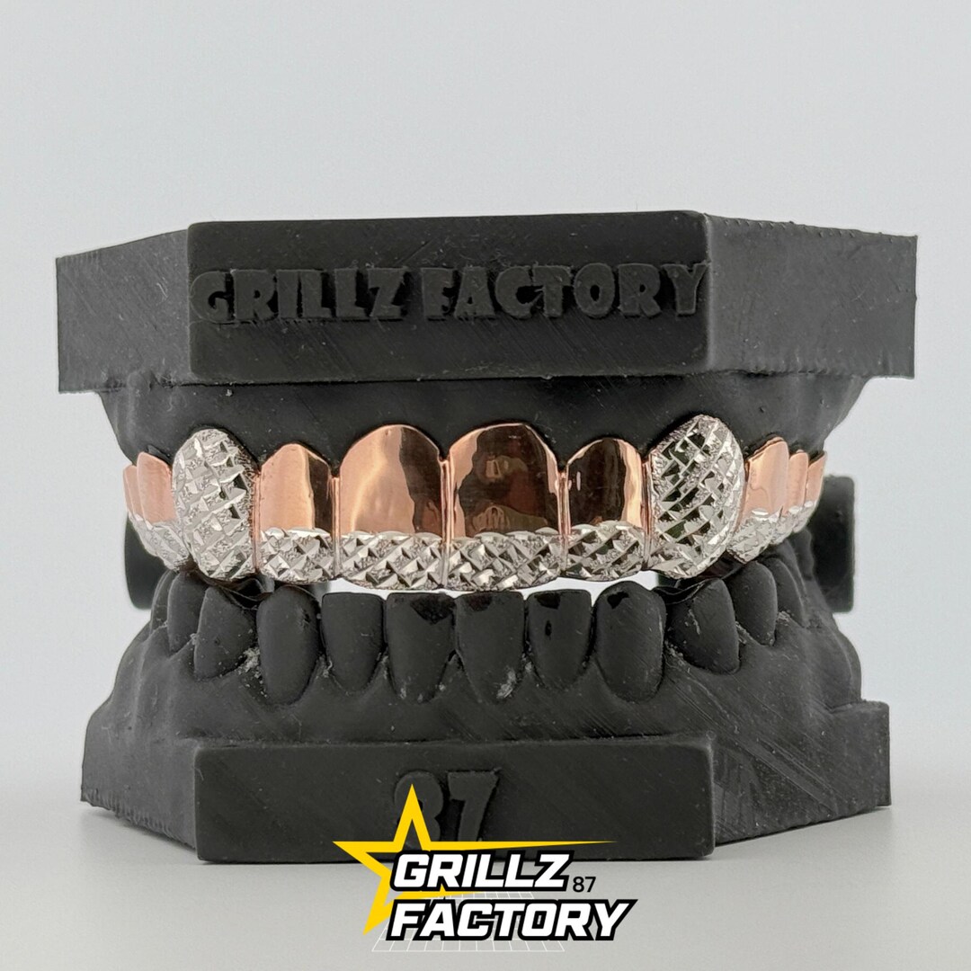 Rose Gold & Iced Out Grillz: Custom Fit 10K/14K Gold or 925 Silver