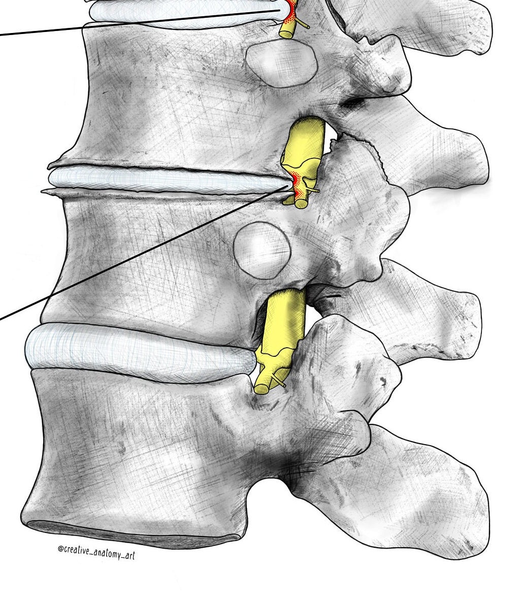 Vertebral Pathologies Vertebral Pathologies - Anatomy - Art - Without Frame - Etsy
