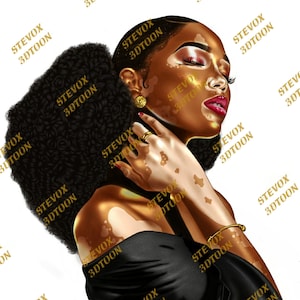 May include: A digital illustration of a woman with vitiligo. She has dark brown hair, red lips, and is wearing a black off-the-shoulder top. The background is white with the text "STEVOX 3DTOON" repeated.