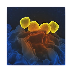 May include: A scanning electron micrograph (SEM) image showing a group of yellow bacteria on a blue and orange background.