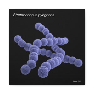 May include: A microscopic image of Streptococcus pyogenes bacteria, a type of bacteria that can cause strep throat and other infections. The image shows a cluster of purple-colored bacteria.