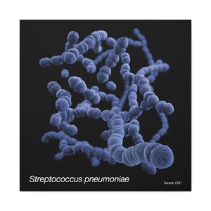 May include: A microscopic image of Streptococcus pneumoniae bacteria, a common cause of pneumonia, shown in a chain-like formation. The bacteria are blue and appear against a black background. Source: CDC