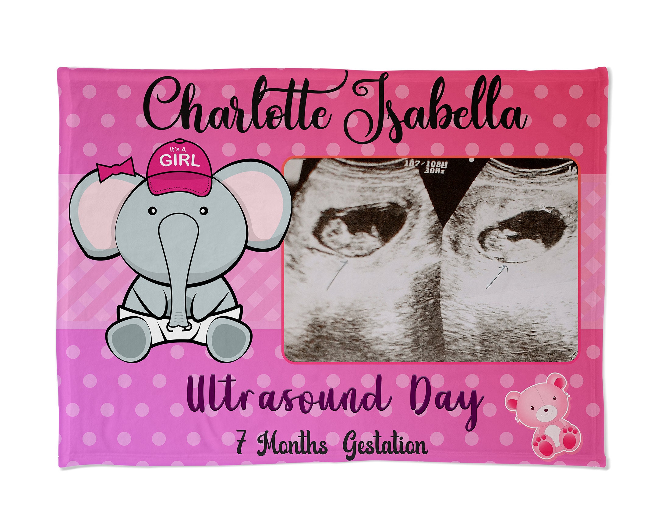 Ultrasound Day Blanket Girl, Custom Baby Blanket for Girl, Personalized
