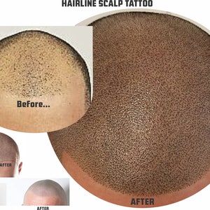 TEMPORARY TATTOO SCALP Hairline