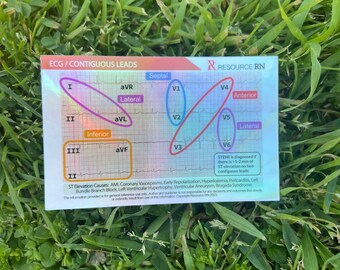 Glitter Sticker EKG STEMI Reference Tool RN Card - Etsy