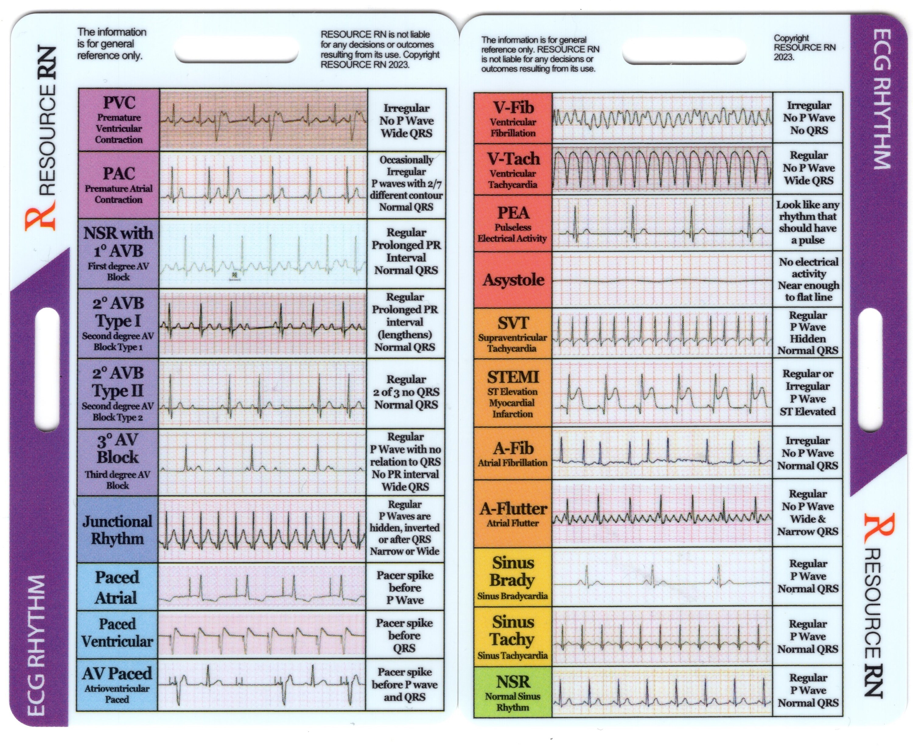 Bestseller Set - Rapid and Quick Cardiac Analysis Measurement Tool (Vertical), ECG/EKG STEMI reference, Rhythm Badge Card Pocket Guide