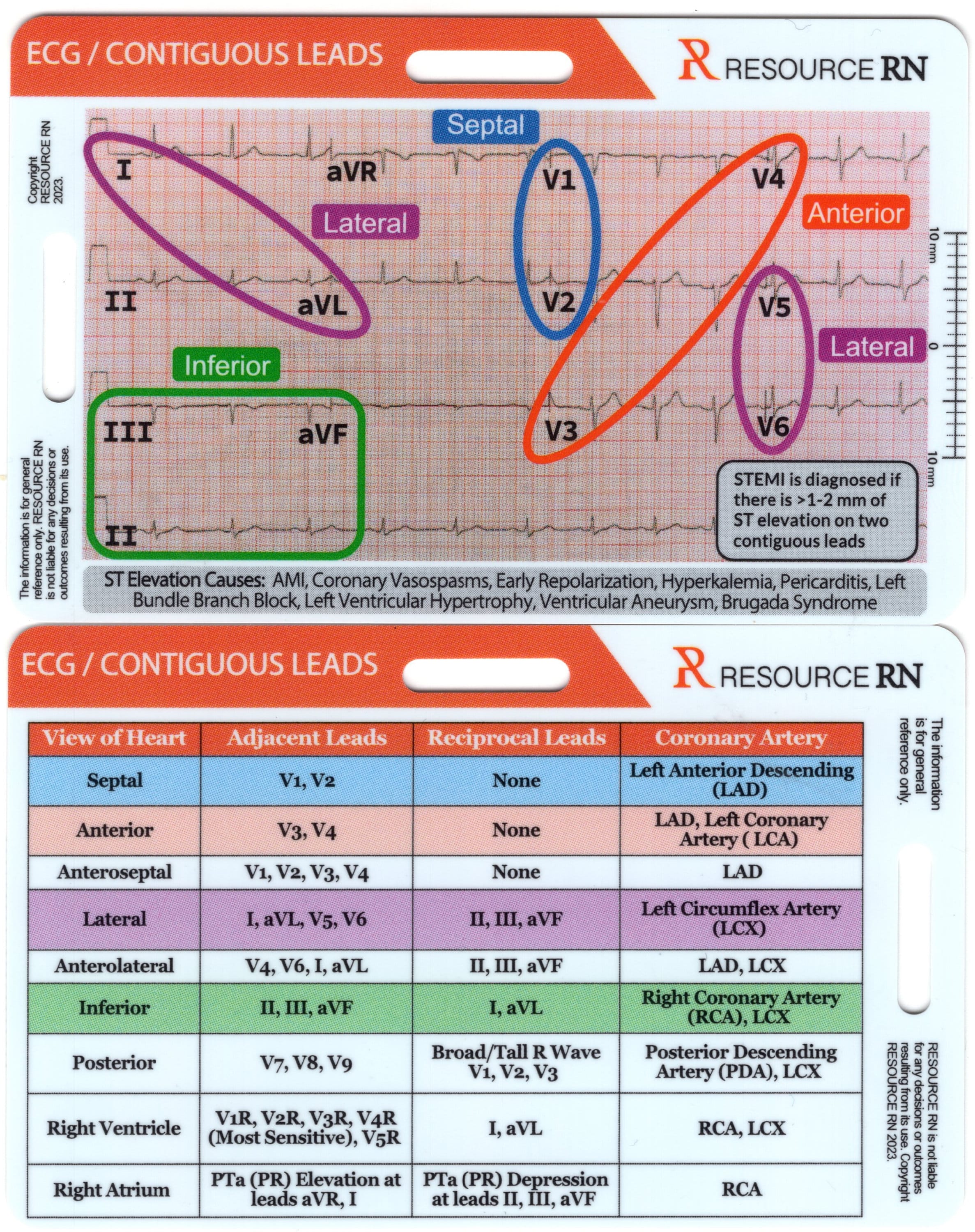 Cardiac Nursing Badge Card Set: ECG Interpretation, Heart Sounds - Etsy