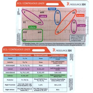 EKG STEMI Reference Tool - Horizontal and Vertical Badge Card Pocket ...