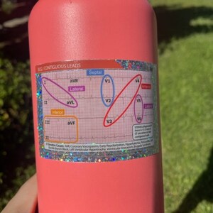 Glitter Sticker EKG STEMI Reference Tool RN Card - Etsy