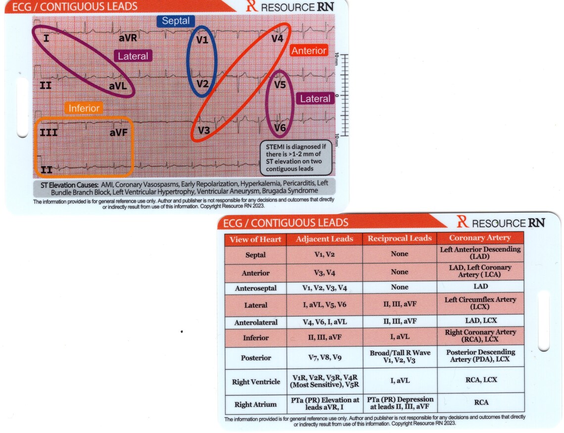 EKG STEMI Reference Tool VERTICAL Badge Card Pocket Guide - Etsy