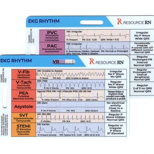 May include: Two rectangular white reference cards titled EKG RHYTHM by Resource RN. The cards feature color-coded rows detailing various heart rhythms including V-Fib, V-Tach, PEA, Asystole, SVT, STEMI, PVC, and PAC with corresponding EKG tracings.