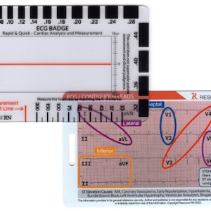 May include: A white plastic card with a red line and a ruler marked in millimeters. The card has the text "ECG BADGE" and "Rapid & Quick - Cardiac Analysis and Measurement". The card also has a diagram of a heart with different leads labeled. The text "STEMI is diagnosed if there is 1-2 mm of ST elevation on two contiguous leads" is also on the card.