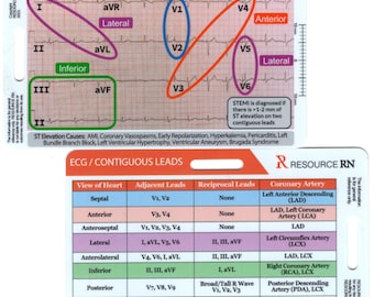 May include: A color-coded chart showing the location of the heart's electrical activity on an electrocardiogram (ECG). The chart shows the 12 standard ECG leads and their corresponding locations on the heart. The chart also includes information about the causes of ST elevation, such as acute myocardial infarction (AMI), coronary vasospasms, and early repolarization.
