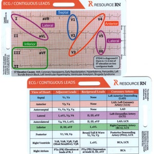 ECG/EKG Reference Badge Card Set: Cardiac Analysis Tool - Etsy Australia
