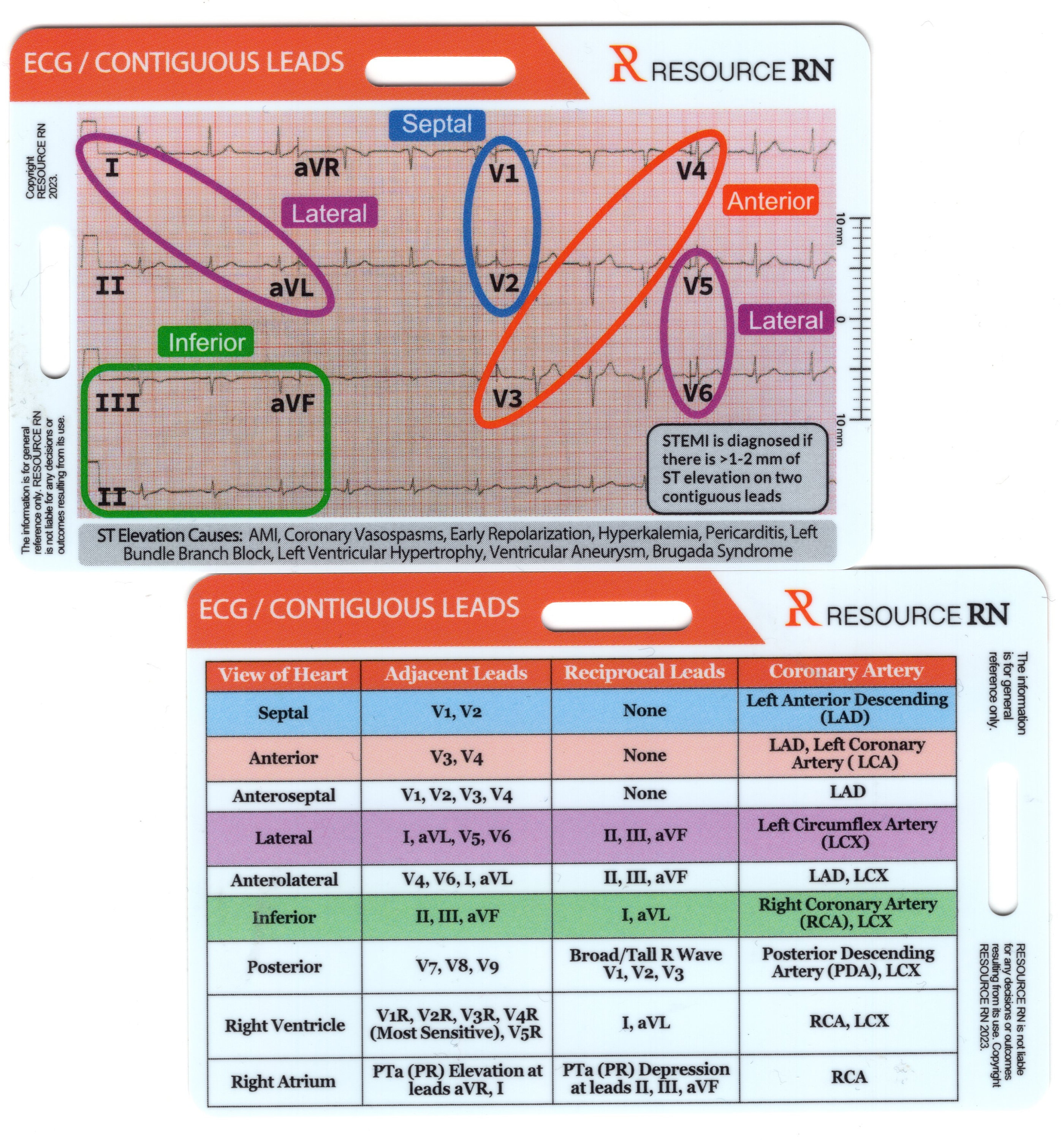 Bestseller Set - Rapid and Quick Cardiac Analysis Measurement Tool (Vertical), ECG/EKG STEMI reference, Rhythm Badge Card Pocket Guide