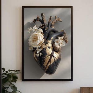 Black Anatomical Heart Floral Canvas Print, Gold Kintsugi Wall Art