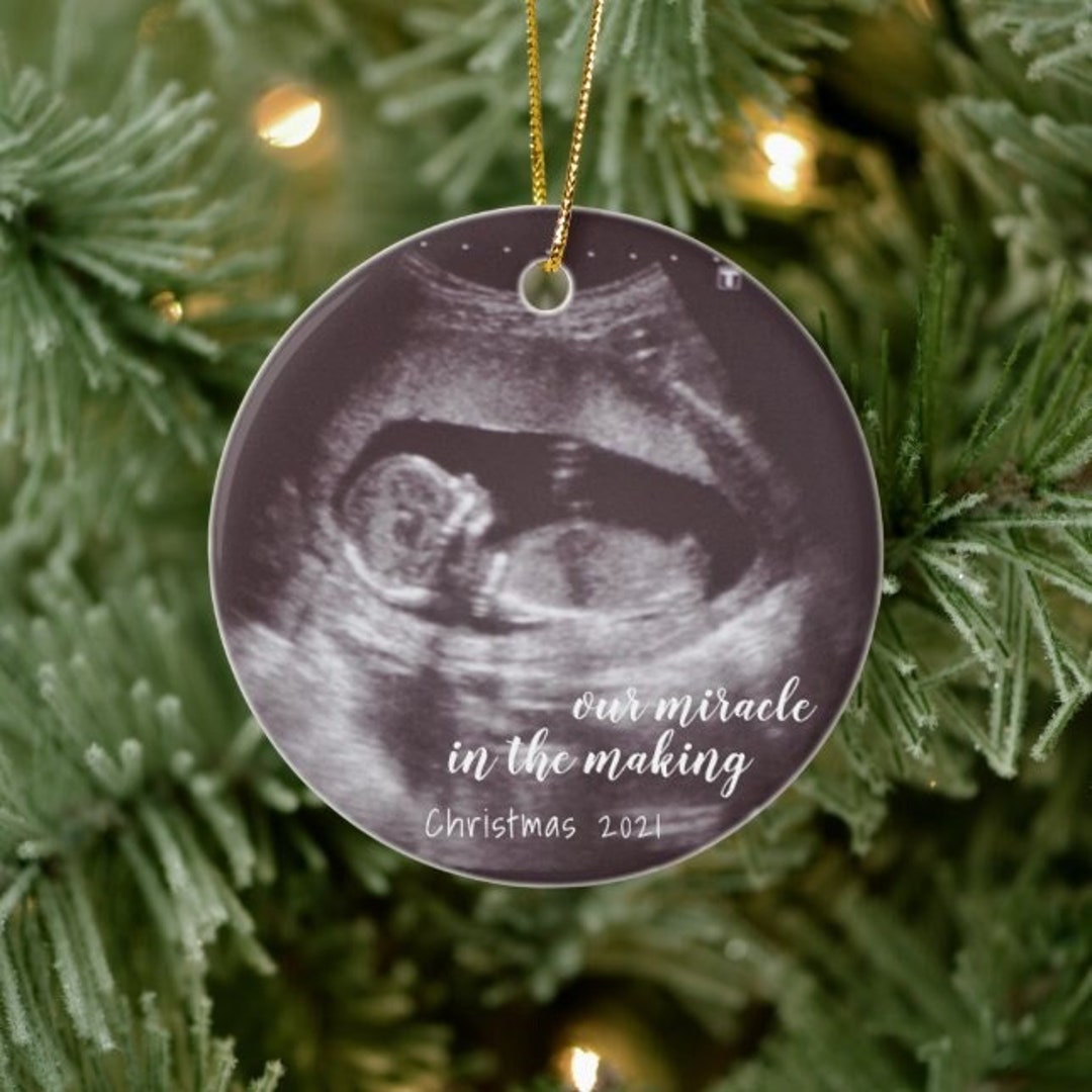 Ultrasound Christmas Ornament 