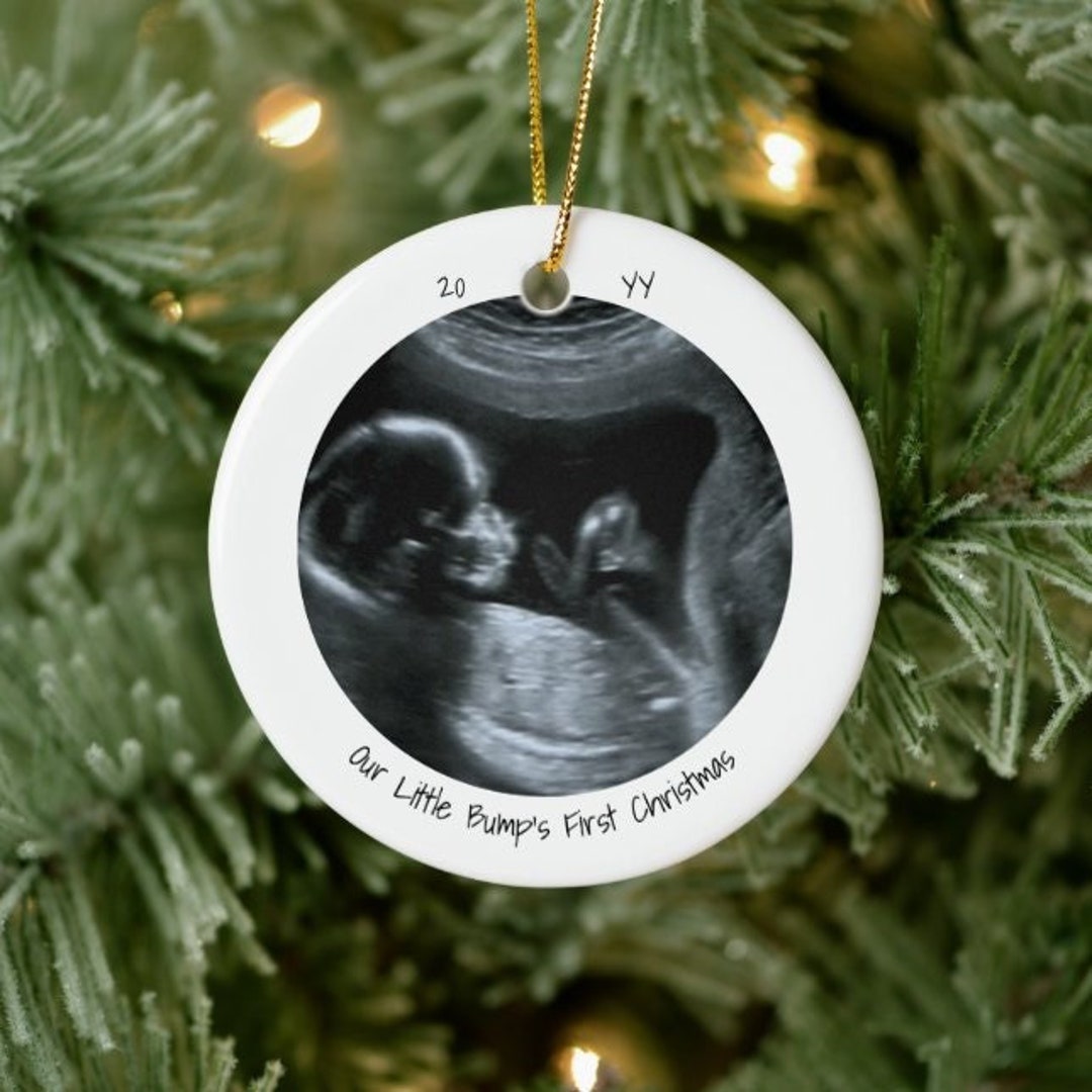 Ultrasound Christmas Ornament 