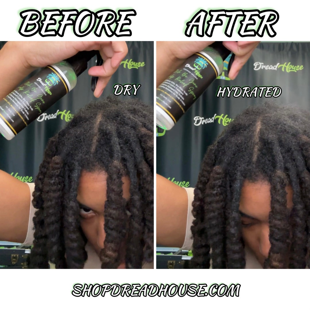 Itchy Dreadlocks Scalp Loc Spray Hydration Mist Loc Mist Spray ANTI