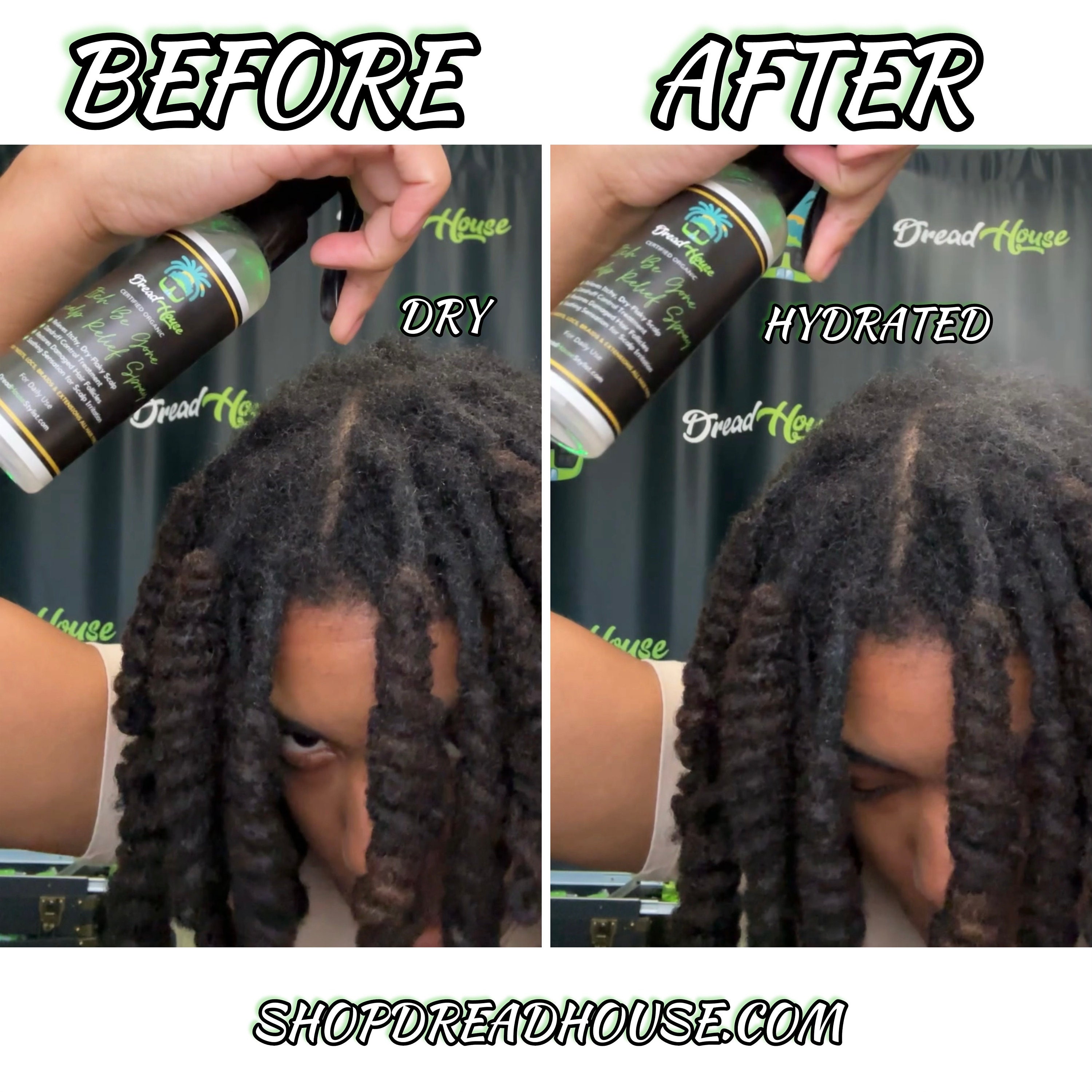 Itchy Dreadlocks Scalp Loc Spray Hydration Mist Loc Mist Spray ANTI ITCH Itchy Hair Dreadlocks Locs Locks Twists Braids Natural Hair Spray