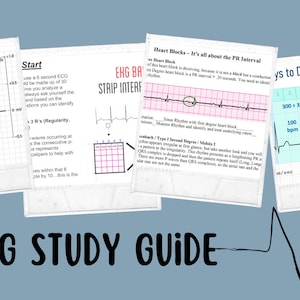 EKG Study Guide